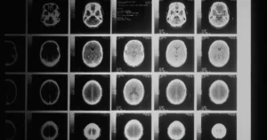 Featured image for How Can I Know My Real IQ The Ultimate Guide 2025