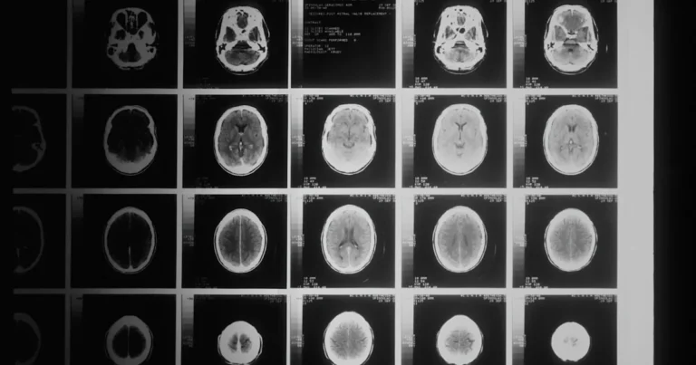 Featured image for How Can I Know My Real IQ The Ultimate Guide 2025